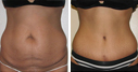Before & After Photos